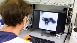 An employee of the vaccine company Bavarian Nordic shows a picture of a vaccine virus on a display in a laboratory of the company in Martinsried near Munich, Germany