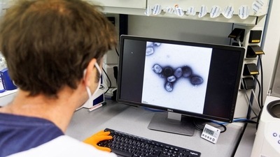 An employee of the vaccine company Bavarian Nordic shows a picture of a vaccine virus on a display in a laboratory of the company in Martinsried near Munich, Germany (REUTERS)