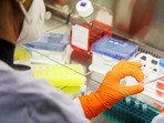 Monkeypox: An employee of the vaccine company Bavarian Nordic works in a laboratory of the company in Martinsried near Munich, Germany, The company, headquartered in Denmark, is the only one in the world to have approval for a smallpox vaccine called Jynneos in the U.S. and Imvanex in Europe, which is also effective against monkeypox.&nbsp;