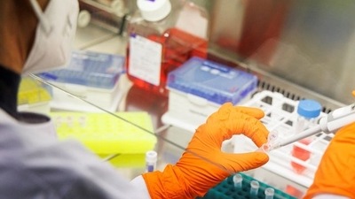 Monkeypox: An employee of the vaccine company Bavarian Nordic works in a laboratory of the company in Martinsried near Munich, Germany, The company, headquartered in Denmark, is the only one in the world to have approval for a smallpox vaccine called Jynneos in the U.S. and Imvanex in Europe, which is also effective against monkeypox.&nbsp; (REUTERS)