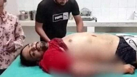 Sidhu Moose Wala was brought to Mansa Civil Hospital in critical condition and died of his injuries shortly afterwards.