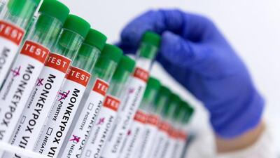 Since May 13, the World Health Organization has received reports of infections from at least 23 countries (REUTERS) Since May 13, the World Health Organization has received reports of infections from at least 23 countries (REUTERS)