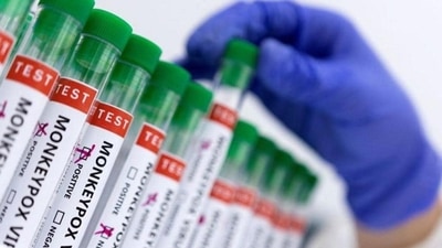 7. Prevention: In case of monkeypox, contact must be avoided with the infected person, animal, or any material like the bedding of the infected person while in chickenpox, vaccination must be taken to prevent infection. (Reuters) 7. Prevention: In case of monkeypox, contact must be avoided with the infected person, animal, or any material like the bedding of the infected person while in chickenpox, vaccination must be taken to prevent infection. (Reuters)