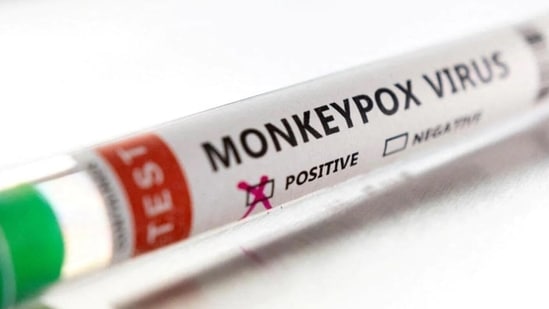 5. Incubation period of monkeypox is from 5 to 21 days while that of chickenpox lasts from 4 to 7 days.(Reuters)