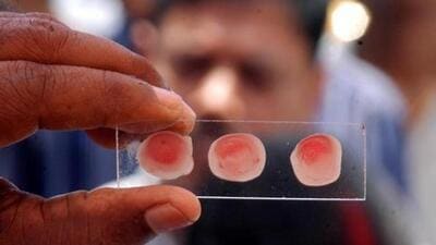 Family members of two patients alleged that their kin were given the wrong blood group by Keonjhar district headquarter hospital leading to their death. (HT/Representational Image) Family members of two patients alleged that their kin were given the wrong blood group by Keonjhar district headquarter hospital leading to their death. (HT/Representational Image)