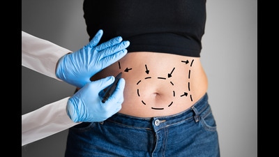There are two types of liposuction procedures — of less than five litres and more than five litres — and the former is considered safer. (Photo: Shutterstock) There are two types of liposuction procedures — of less than five litres and more than five litres — and the former is considered safer. (Photo: Shutterstock)