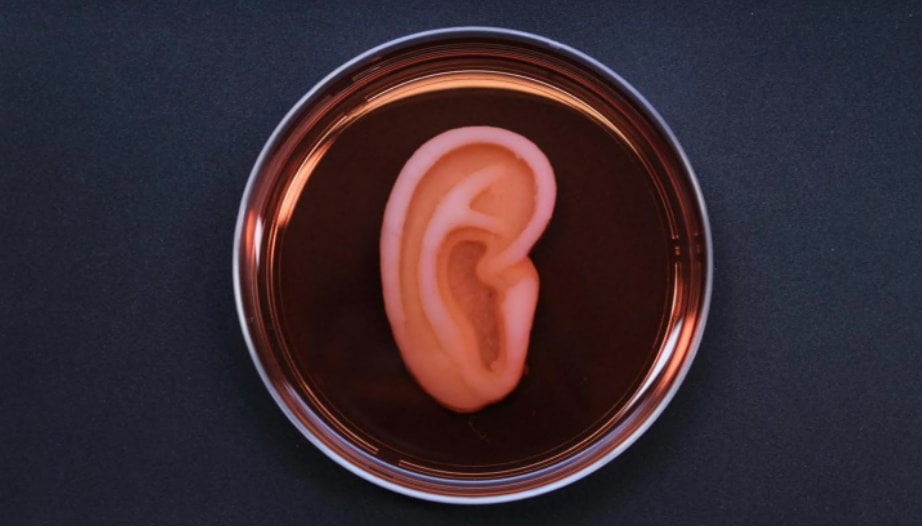 Living ear tissue bioprinted by 3DBio Therapeutics. (Photo: 3DBio Therapeutics) Living ear tissue bioprinted by 3DBio Therapeutics. (Photo: 3DBio Therapeutics)