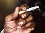 How does smoking affect hair transplant results? Expert shares insights