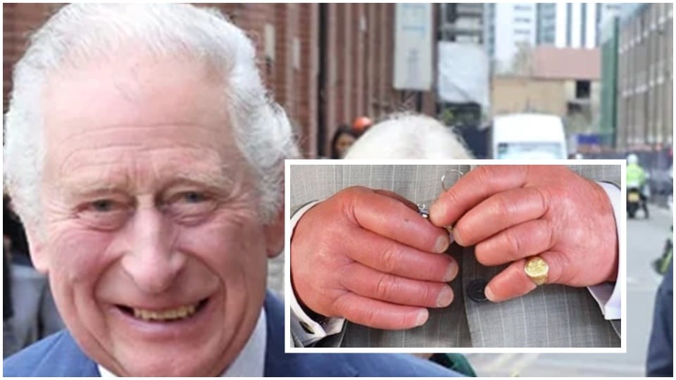 Recent pictures of Prince Charles' swollen fingers have once caught attention of internet community who showed their concern over the royal's condition Recent pictures of Prince Charles' swollen fingers have once caught attention of internet community who showed their concern over the royal's condition