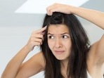 According to Ayurveda, dandruff is caused by imbalance in doshas.(Shutterstock) According to Ayurveda, dandruff is caused by imbalance in doshas.(Shutterstock)