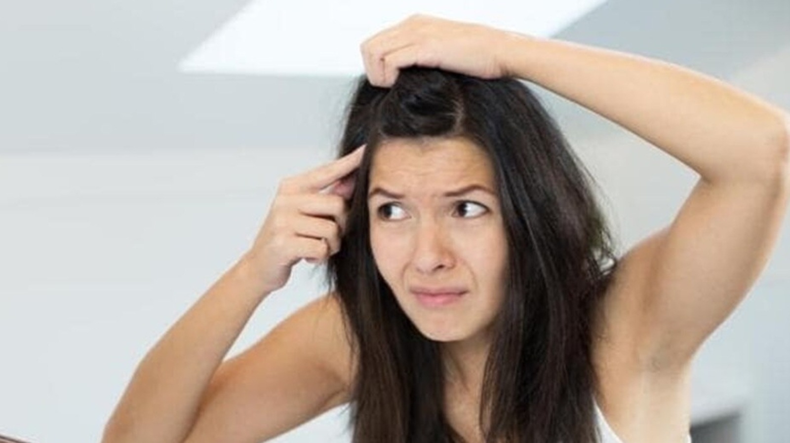 Easy Ayurvedic remedies to get rid of dandruff | Health - Hindustan Times Easy Ayurvedic remedies to get rid of dandruff | Health - Hindustan Times