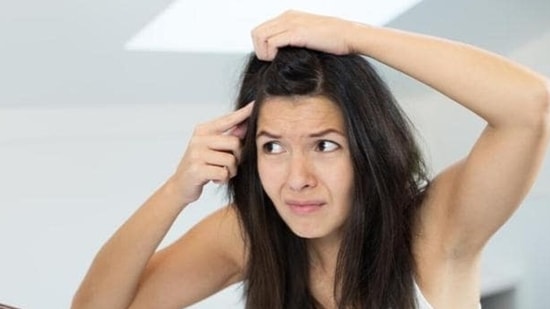 According to Ayurveda, dandruff is caused by imbalance in doshas.(Shutterstock)