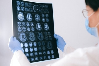 World Brain Tumour Day 2022: Early signs of brain tumour among youngsters (Anna Shvets) World Brain Tumour Day 2022: Early signs of brain tumour among youngsters (Anna Shvets)