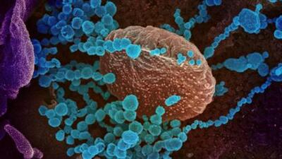 While the daily Covid cases have been fluctuating in the Chandigarh tricity, they had never crossed the 40 mark for the past 104 days. (via REUTERS)