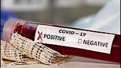 Of 30 active Covid cases in Ludhiana, 28 are under home isolation (HT FILE)