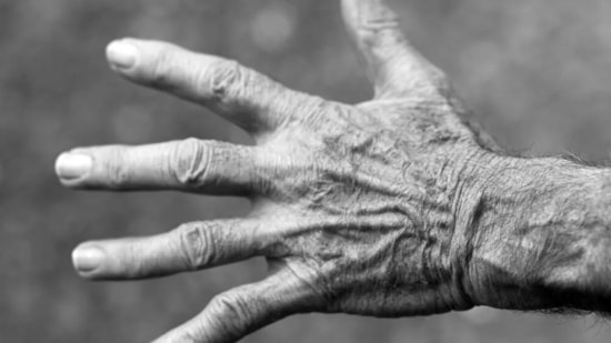 Bruises on the body: Unidentified bruises on an elderly's body could indicate that they are unable to care for themselves. Fall or cut bruises are difficult to diagnose. As a result, a family member should remember to check on them for any potential injuries.(Pixabay)