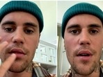 Justin Bieber says he trusts God and hopes to get better with time by resting and doing a series of facial exercises.(Justin Bieber/Instagram) Justin Bieber says he trusts God and hopes to get better with time by resting and doing a series of facial exercises.(Justin Bieber/Instagram)