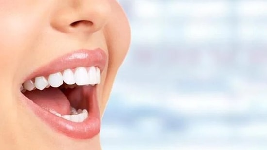 Bad breath could also be a sign of peridontal or gum diseases and one must visit their dentist to know the exact cause.(Shutterstock) Bad breath could also be a sign of peridontal or gum diseases and one must visit their dentist to know the exact cause.(Shutterstock)