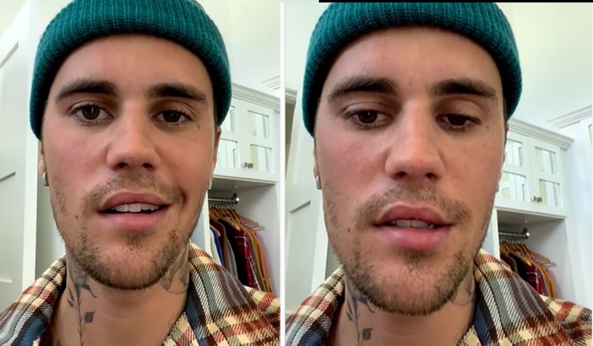 Justin Bieber shares update on Ramsay Hunt syndrome recovery 'This(02)