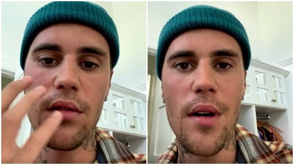 Justin Bieber says he trusts God and hopes to get better with time by resting and doing a series of facial exercises. (Justin Bieber/Instagram) Justin Bieber says he trusts God and hopes to get better with time by resting and doing a series of facial exercises. (Justin Bieber/Instagram)