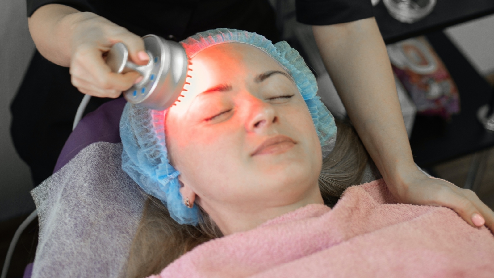 Laser ipl facial opiniones hot sale