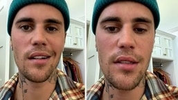 Justin Bieber revealed his Ramsay Hunt syndrome diagnosis on June 10 via Instagram.