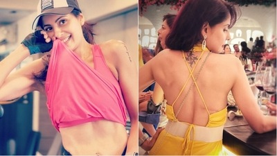 Chhavi Mittal has spoken about the side effects of radiation. Chhavi Mittal has spoken about the side effects of radiation.