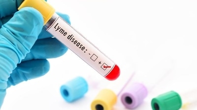 The bacteria Borrelia burgdorferi (Bb), which causes the disease, was found in the blood of 14.5 percent of the nearly 160,000 total participants. (Shutterstock) The bacteria Borrelia burgdorferi (Bb), which causes the disease, was found in the blood of 14.5 percent of the nearly 160,000 total participants. (Shutterstock)