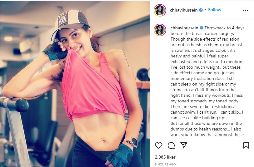 Chhavi shared a throwback photo which she clicked ahead of her surgery.