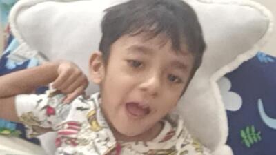 Four-year old Palaash was detected with a rare genetic abnormality – ANO3, resulting in a condition called progressive primary dystonia- a movement disorder at the age of one (HT Photo) Four-year old Palaash was detected with a rare genetic abnormality – ANO3, resulting in a condition called progressive primary dystonia- a movement disorder at the age of one (HT Photo)