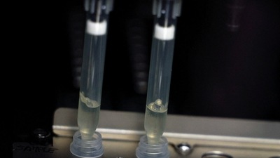 FILE PHOTO: Two samples of suspected cases of monkeypox go through a process of nucleic acid extraction as they get tested at a microbiology lab at La Paz Hospital in Madrid, Spain, (REUTERS)