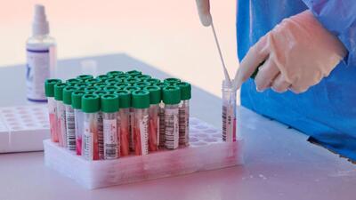 Tricity recorded 99 Covid cases on Monday, of which 45 came from Chandigarh. No virus-related fatality was recorded on the day. (AFP)