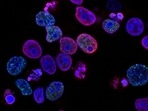 Study suggests new effective combination therapy for pediatric T-acute leukemia(Unsplash) Study suggests new effective combination therapy for pediatric T-acute leukemia(Unsplash)