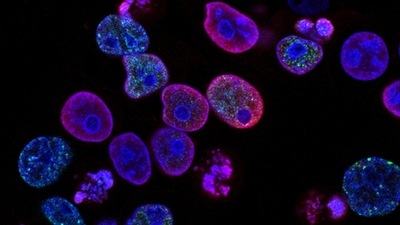 Study suggests new effective combination therapy for pediatric T-acute leukemia (Unsplash) Study suggests new effective combination therapy for pediatric T-acute leukemia (Unsplash)