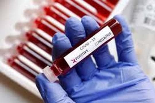 Karnataka saw over 900 new cases of COVID-19 within 24 hours and also recorded one death on Tuesday. (Representative image)