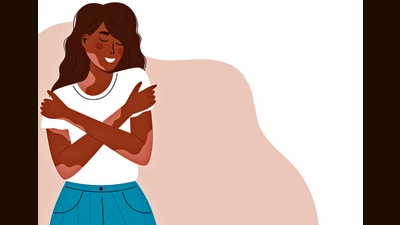 Vitiligo is an autoimmune disease that occurs due to the lack of a pigment called melanin (Shutterstock) Vitiligo is an autoimmune disease that occurs due to the lack of a pigment called melanin (Shutterstock)