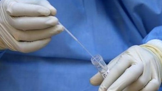 According to the Indian Council of Medical Research (ICMR), over 3.63 lakh samples were tested for Covid in the last 24 hours.(HT file photo) According to the Indian Council of Medical Research (ICMR), over 3.63 lakh samples were tested for Covid in the last 24 hours.(HT file photo)
