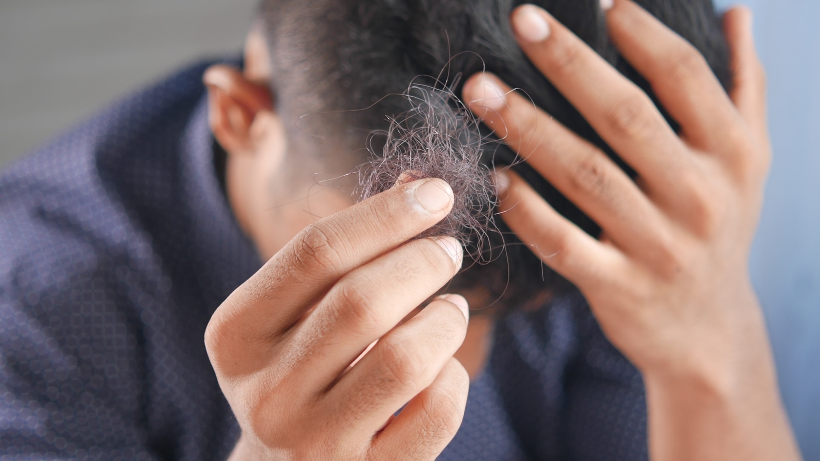 Suffering from hair loss? Here are a few superfoods you need to add to your diet immediately