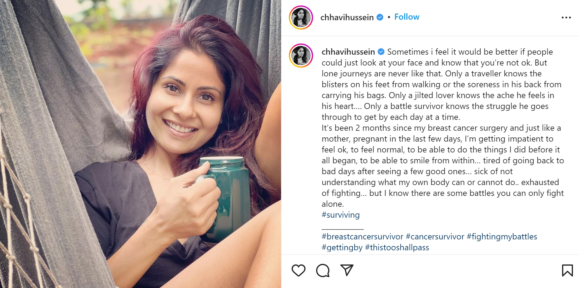 Chhavi Mittal On Completing Two Months Of Cancer Surgery ‘getting Impatient Web Series