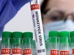 In many European countries, monkeypox cases are rising, In many European countries, monkeypox cases are rising,