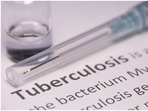TB has been one of the biggest public health challenges in India. However, India is committed to end TB by 2025 — ahead of the year 2030 — the target set under the SDGs.&nbsp;