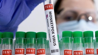 In many European countries, monkeypox cases are rising, (Reuters) In many European countries, monkeypox cases are rising, (Reuters)