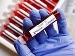 Karnataka saw over 900 new cases of COVID-19 within 24 hours and also recorded one death on Tuesday. (Representative image) Karnataka saw over 900 new cases of COVID-19 within 24 hours and also recorded one death on Tuesday. (Representative image)