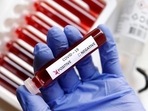 Since mid-June, the city has reported cases of BA.5 from the All India Institute of Medical Sciences (AIIMS), Lok Nayak Hospital and Institute of Liver and Biliary Sciences (ILBS), according to scientists privy to genome sequencing data of Delhi. (REUTERS (PIC FOR REPRESENTATION)) Since mid-June, the city has reported cases of BA.5 from the All India Institute of Medical Sciences (AIIMS), Lok Nayak Hospital and Institute of Liver and Biliary Sciences (ILBS), according to scientists privy to genome sequencing data of Delhi. (REUTERS (PIC FOR REPRESENTATION))
