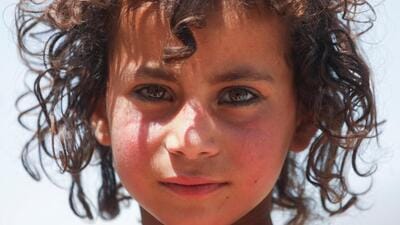 Zar Ghadam, an Afghan girl, poses for a photograph in Kalizei village in the Gayan district of Paktika province of Afghanistan (REUTERS File Photo) Zar Ghadam, an Afghan girl, poses for a photograph in Kalizei village in the Gayan district of Paktika province of Afghanistan (REUTERS File Photo)