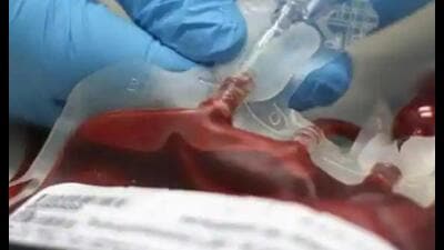 Use of chemical in blood unit is tough to catch unless the “impure blood” is tested in the lab, said the expert. (Pic for representation) Use of chemical in blood unit is tough to catch unless the “impure blood” is tested in the lab, said the expert. (Pic for representation)