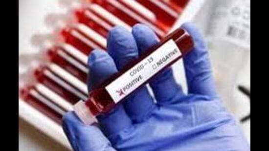 Ludhiana district currently has 230 active Covid cases, of which 223 patients are under home isolation. (Representative image)