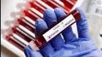 Ludhiana has so far recorded 1,10,516 Covid infections out of which 1,08,034 people have successfully defeated the virus and 2,293 have succumbed to it. (HT File) Ludhiana has so far recorded 1,10,516 Covid infections out of which 1,08,034 people have successfully defeated the virus and 2,293 have succumbed to it. (HT File)