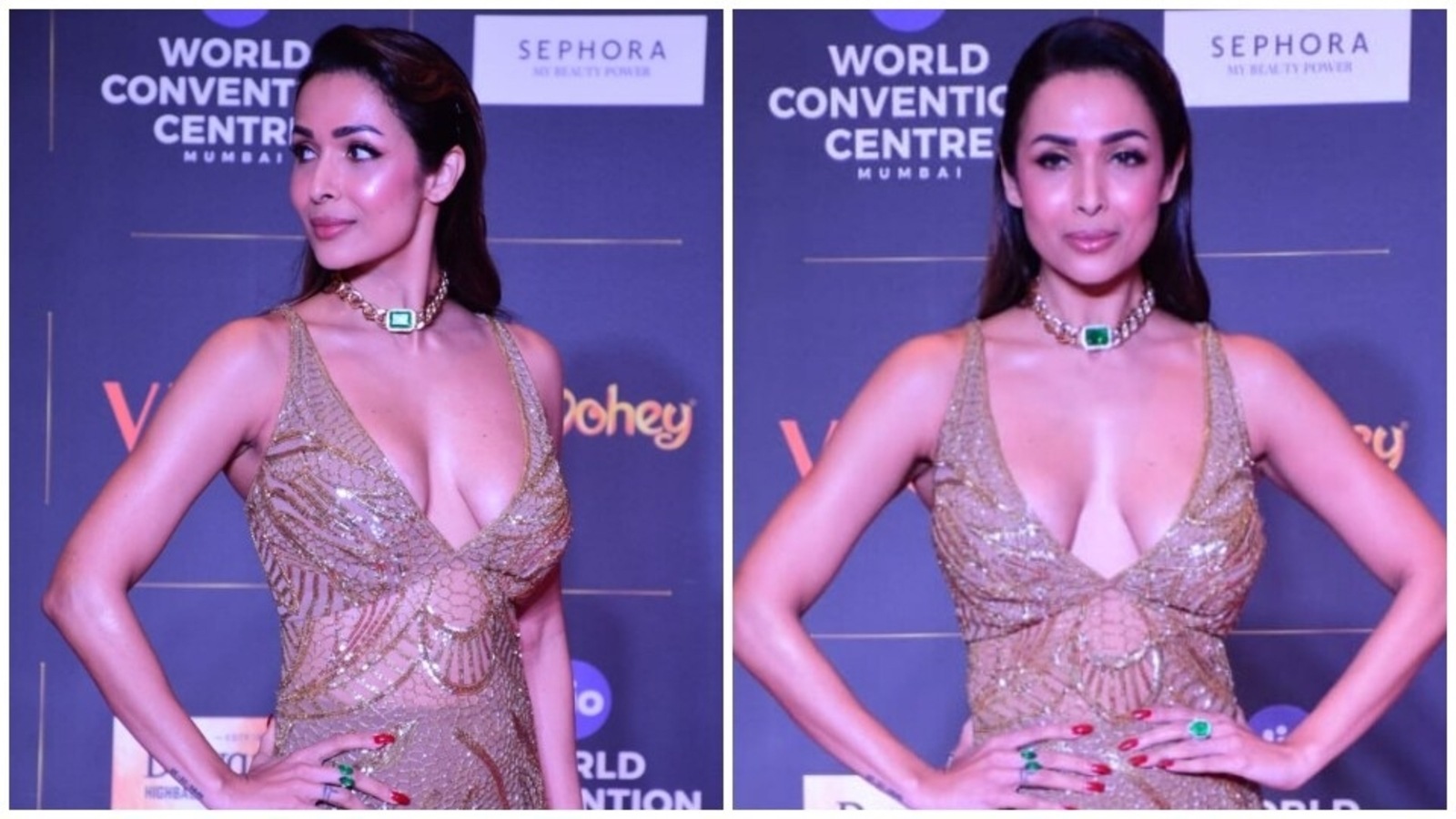 Malaika arora breast implants