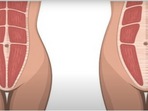 Workout tips: 19 best exercises for repairing diastasis recti postpartum&nbsp;